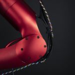 肘部管症候群の手術